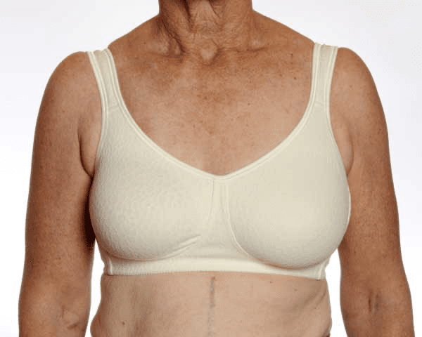 Breast Reconstruction - Dr Kollias